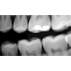 Dantų rentgeno aparatas CS 2100