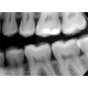 Dantų rentgeno aparatas CS 2200